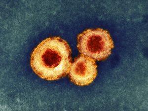 frank-magliochetti-report_hmpv_metapneumovirus_